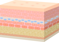 콜라겐 재생으로 진피층이 두꺼워지면서 수분 및 볼륨개선